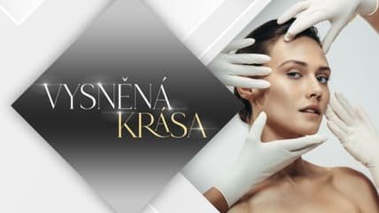 Vysněná krása – 2.díl